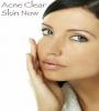 Zamob Acne Clear Skin Now