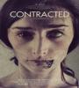 Contracted FZtvseries